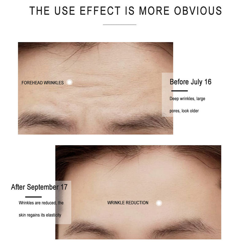 Eye Cream Care