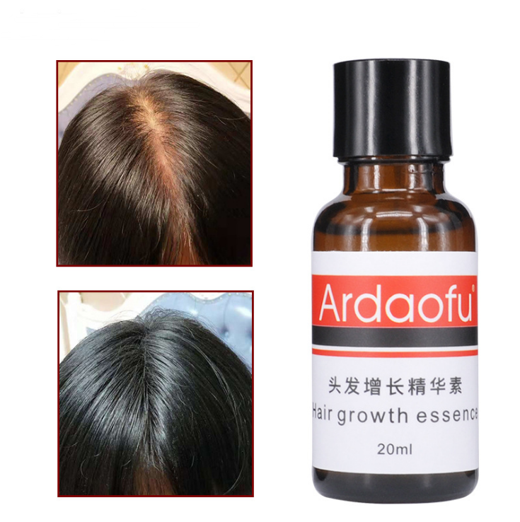 hair growth prevention