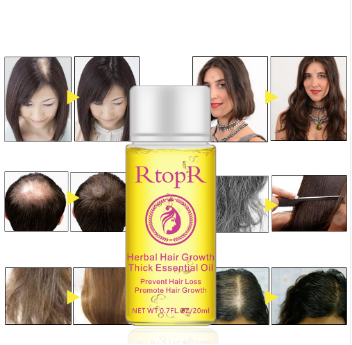 fast powerful hair growth essence products essential oil liquid treatment preventing hair loss hair care 20ml