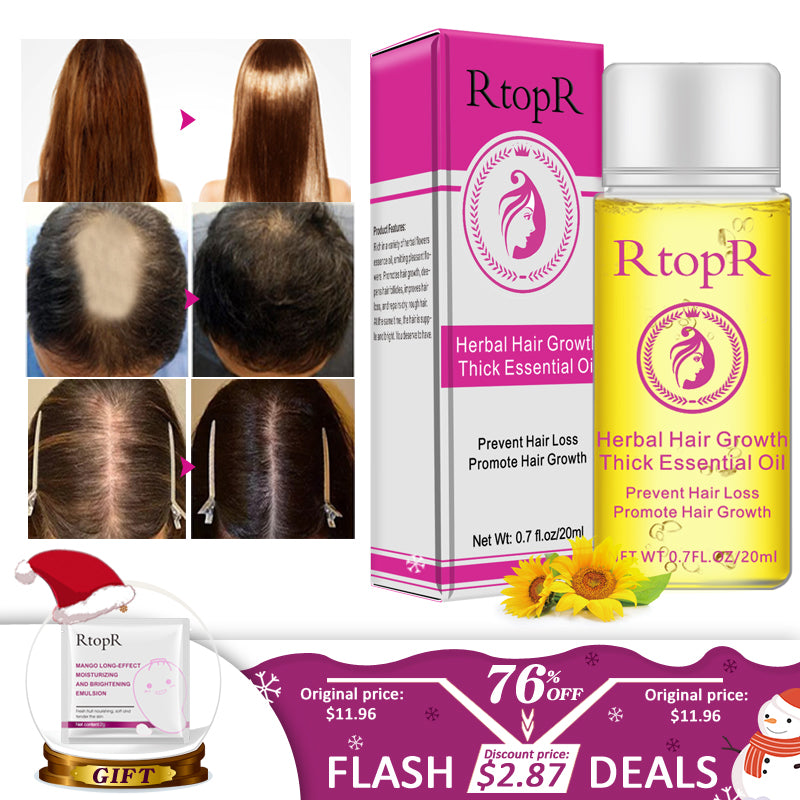 fast powerful hair growth essence products essential oil liquid treatment preventing hair loss hair care 20ml