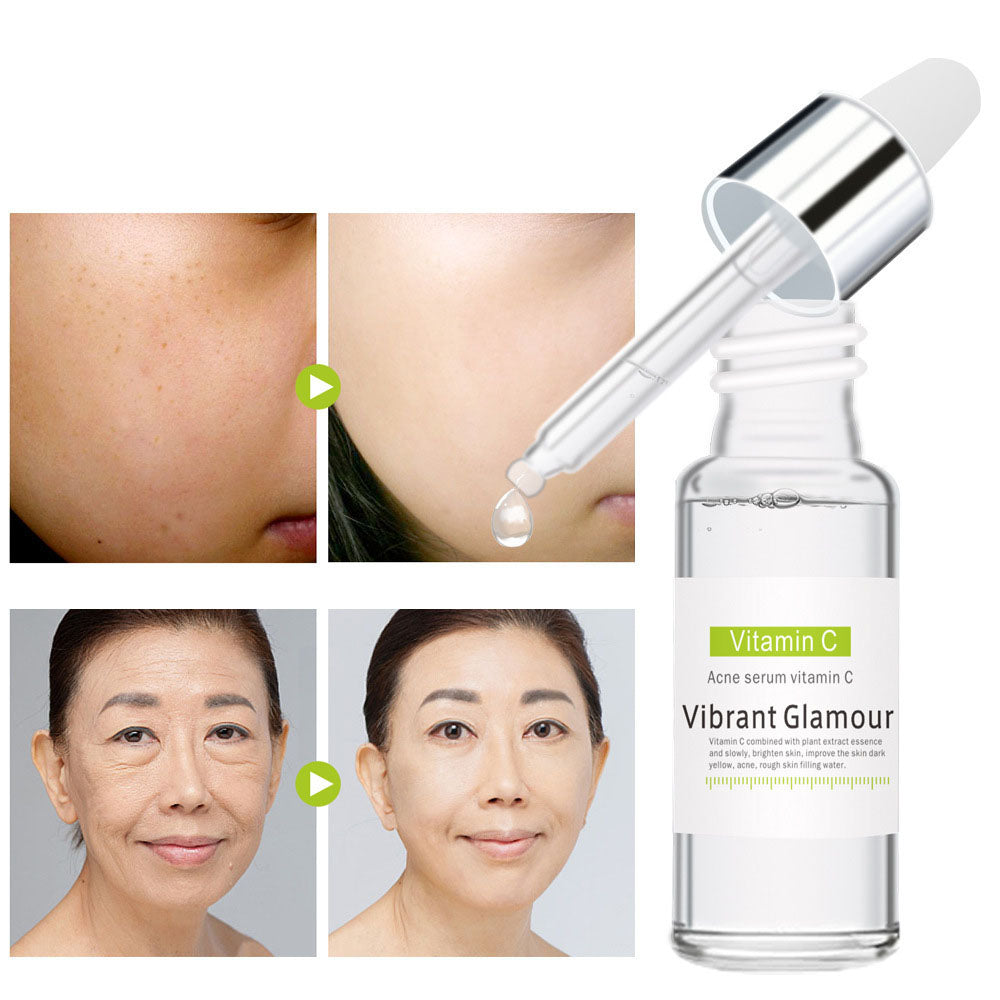 acne essence