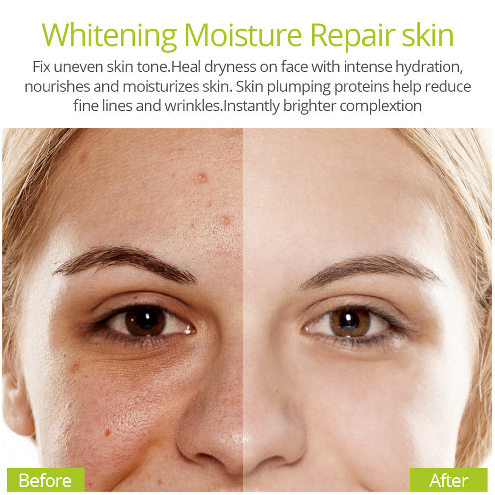 acne essence