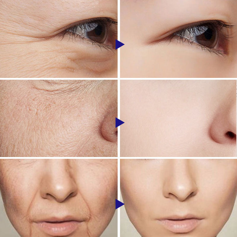 Serum Facial Serum Amazon