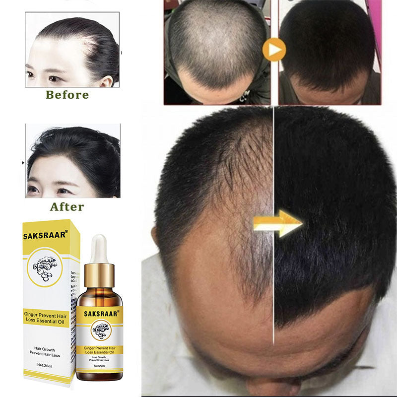Hair Loss Products Natural