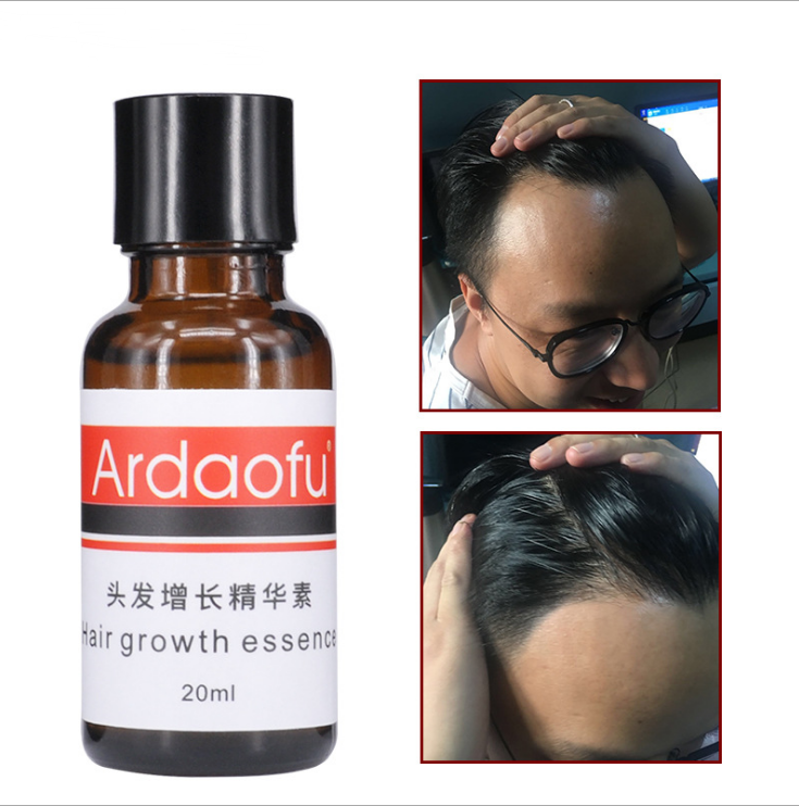 hair growth prevention