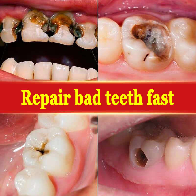 Teeth Fixing Probiotic Toothpaste