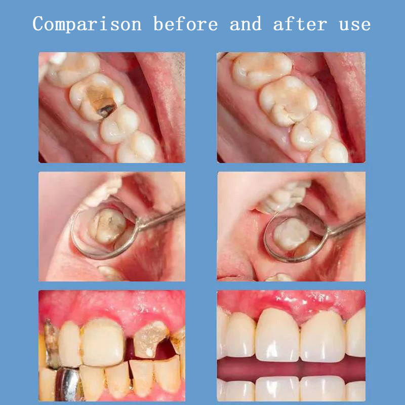 Teeth Fixing Probiotic Toothpaste