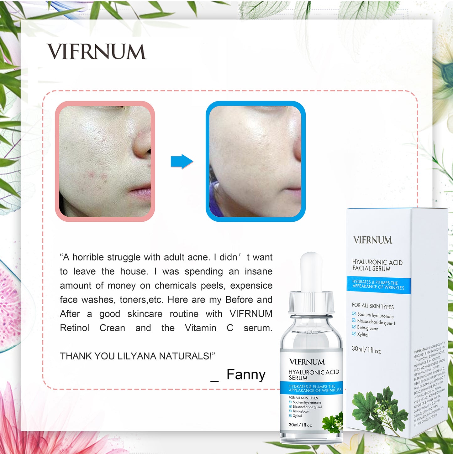 niacinamide facial serum