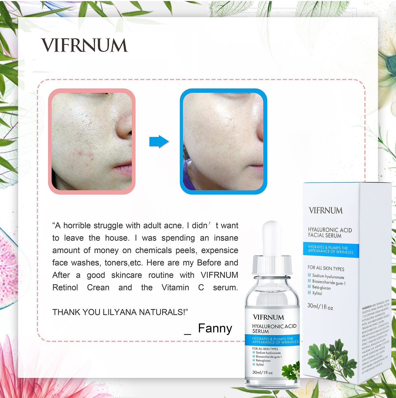 niacinamide facial serum