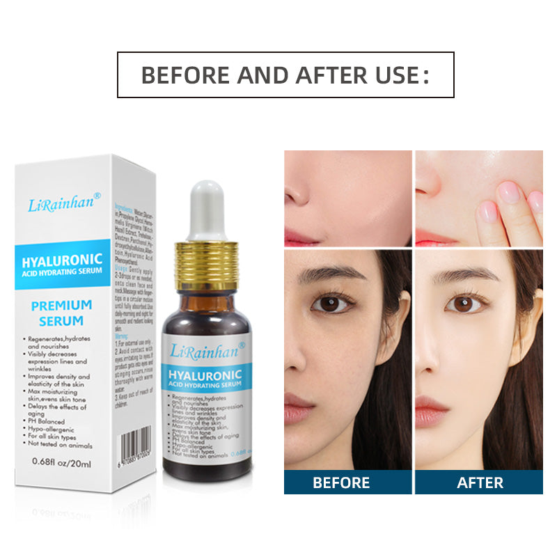 Anti-aging hyaluronic acid serum before and after results.
