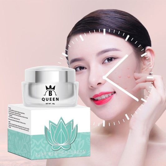 B-Queen Acne Removal Cream with natural ingredients, anti-acne serum, 50g jar.