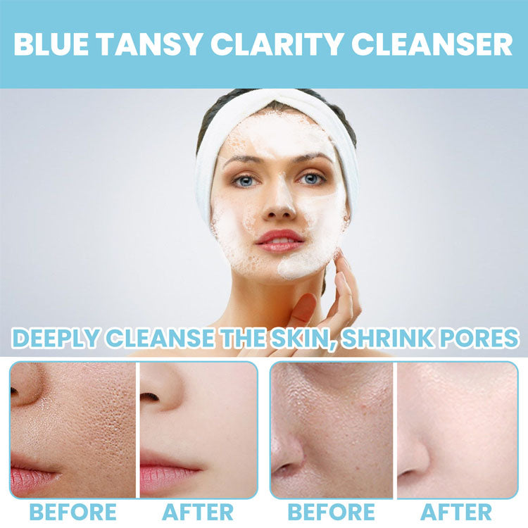 Brightening Foaming Facial Cleanser for deep pore cleansing and oil removal, before and after results shown.