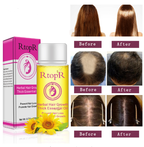 fast powerful hair growth essence products essential oil liquid treatment preventing hair loss hair care 20ml