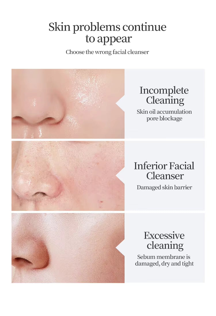 Moisturizing Anti-Acne Daily Cream Cleanser with Amino Acids - Hydrating Makeup Remover