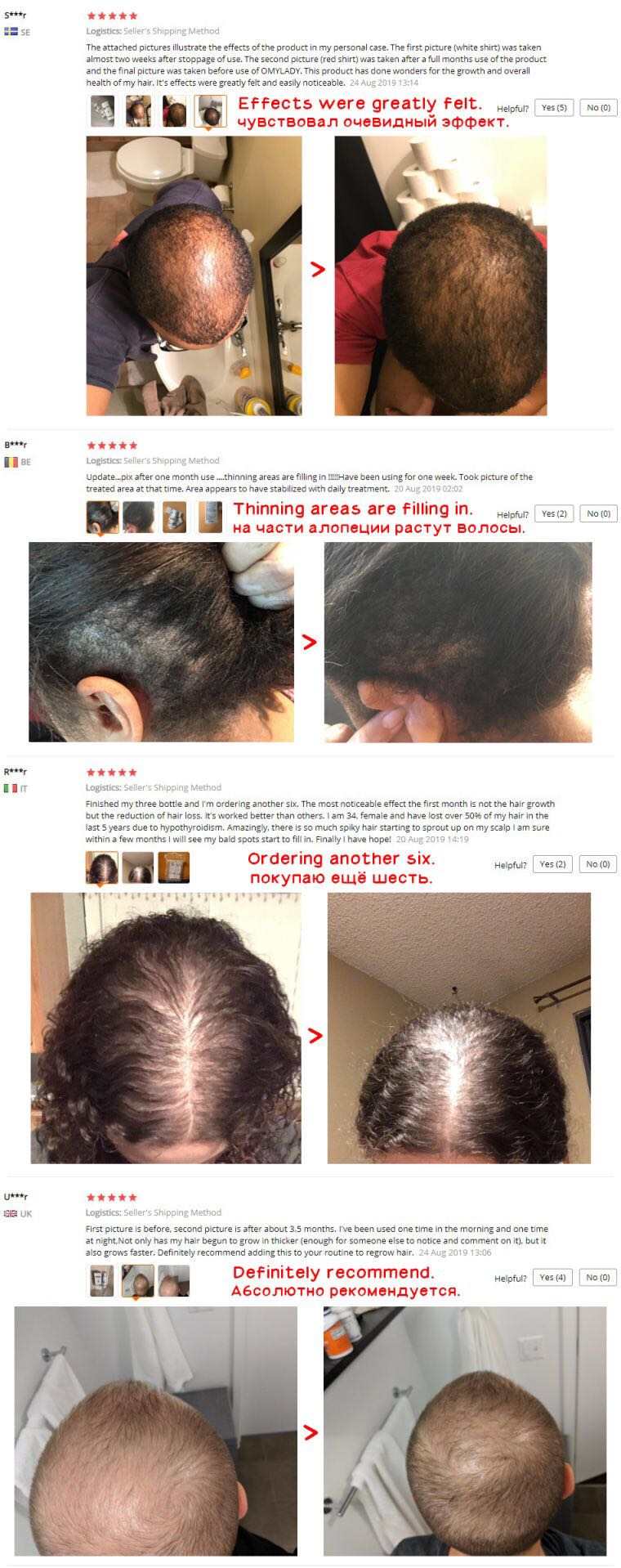 Biotin Hair Growth Spray Natural Organic Hair Growth Serum Spray
