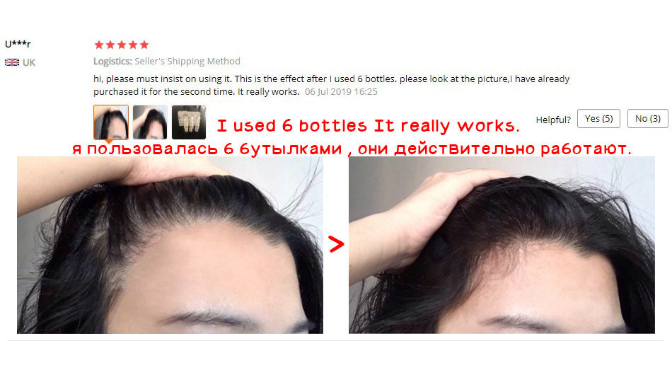 Biotin Hair Growth Spray Natural Organic Hair Growth Serum Spray