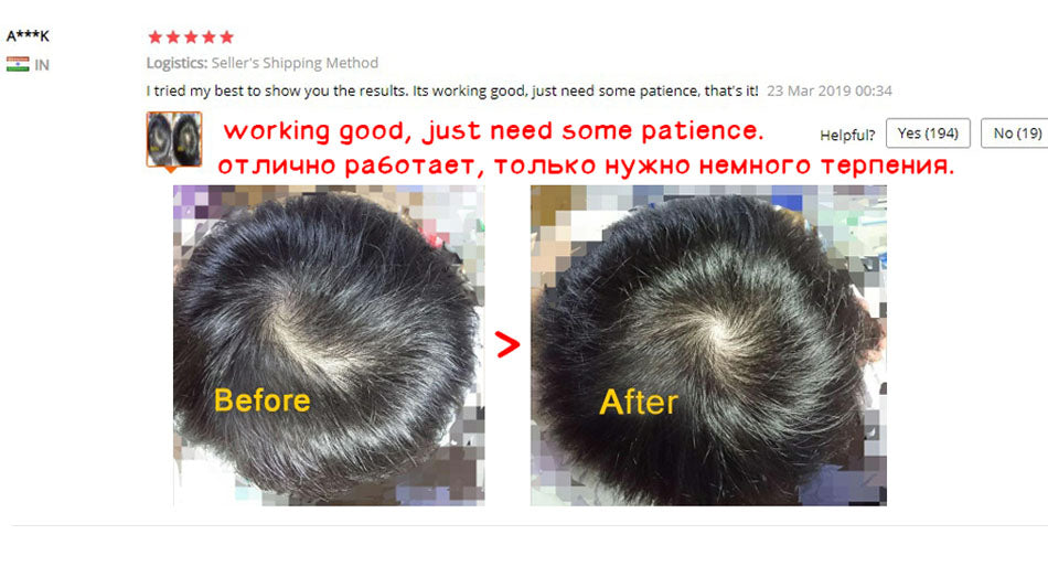Biotin Hair Growth Spray Natural Organic Hair Growth Serum Spray